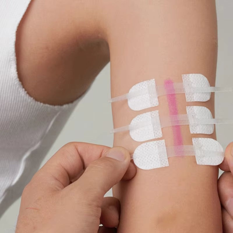 Band-Aid Zipper Tie Wound Closure Patch Hemostatic Patch Wound Fast Suture Zippe
